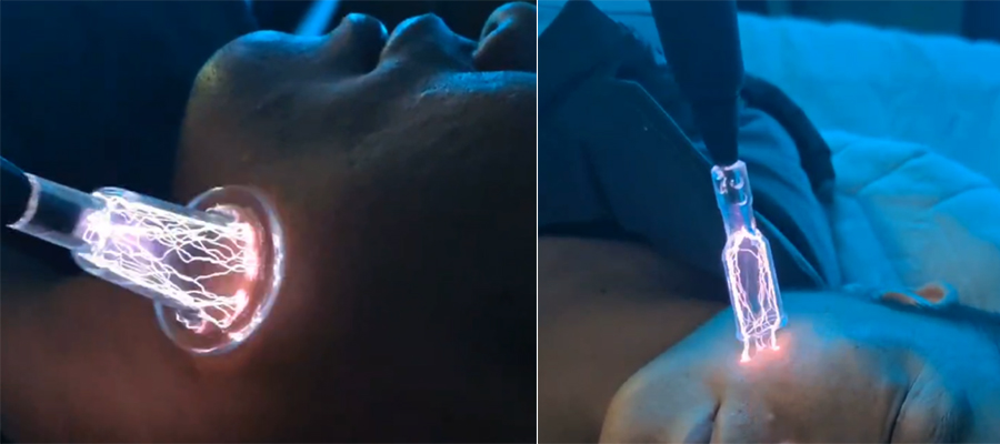 cold plasma